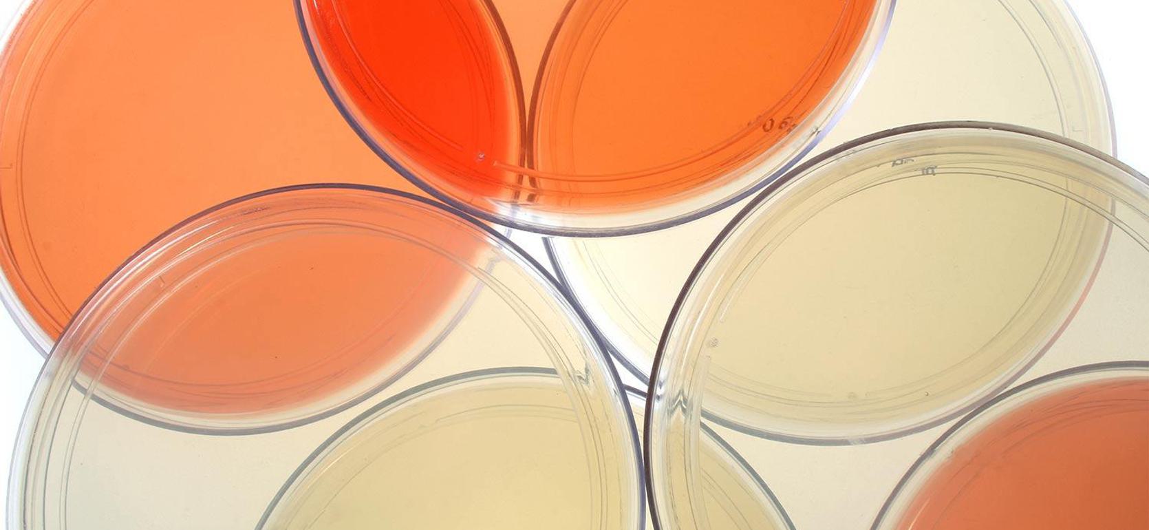 Cell culture that biology degree students at UMHB can study.